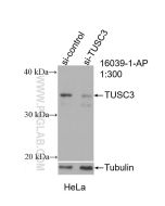TUSC3 Polyclonal antibody 16039-1-AP proteintech