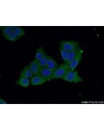 LYPLA1 Polyclonal antibody 16055-1-AP proteintech