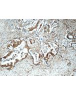 CAP1 Polyclonal antibody 16231-1-AP proteintech