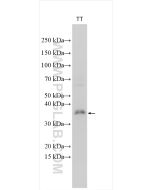 CHMP4C Polyclonal antibody 16256-1-AP proteintech