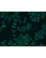 FN3KRP Polyclonal antibody 16312-1-AP proteintech