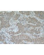 BACE2 Polyclonal antibody 16321-1-AP proteintech