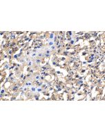 CERCAM Polyclonal antibody 16411-1-AP proteintech