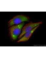 SRI Polyclonal antibody 16471-1-AP proteintech