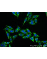 RPS12 Polyclonal antibody 16490-1-AP proteintech