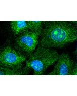RPS14 Polyclonal antibody 16683-1-AP proteintech