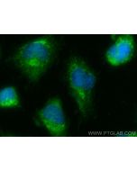 DMPK Polyclonal antibody 16711-1-AP proteintech