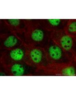 SRF Polyclonal antibody 16821-1-AP proteintech
