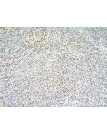 RAB27A Polyclonal antibody 16868-1-AP proteintech