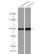 NVL Polyclonal antibody 16970-1-AP proteintech