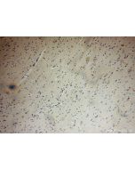 FANCC Polyclonal antibody 16973-1-AP proteintech