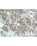 HSDL1 Polyclonal antibody 16988-1-AP proteintech