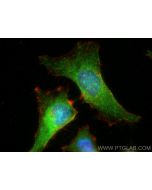 RECQL4 Polyclonal antibody 17008-1-AP proteintech