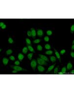 GTF2IRD1 Polyclonal antibody 17052-1-AP proteintech