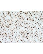 LUC7L Polyclonal antibody 17085-1-AP proteintech