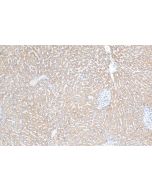 OGDHL Polyclonal antibody 17110-1-AP proteintech