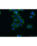 RUNDC3B Polyclonal antibody 17113-1-AP proteintech