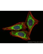 YARS2 Polyclonal antibody 17150-1-AP proteintech