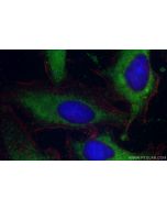 ACAD10 Polyclonal antibody 17161-1-AP proteintech
