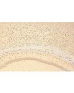 BAT5 Polyclonal antibody 17317-1-AP proteintech
