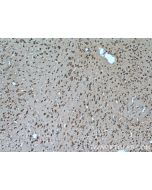 SLC25A18 Polyclonal antibody 17348-1-AP proteintech