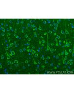 NUBPL Polyclonal antibody 17393-1-AP proteintech