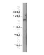 SLC9A11 Polyclonal antibody 17398-1-AP proteintech