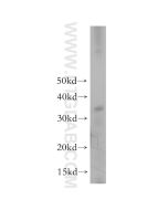 TGIF2LX Polyclonal antibody 17405-1-AP proteintech