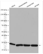 CMBL Polyclonal antibody 17409-1-AP proteintech