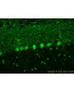 ZNF8 Polyclonal antibody 17448-1-AP proteintech