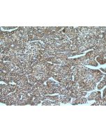 FMO3 Polyclonal antibody 17469-1-AP proteintech