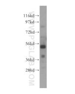 TOM1 Polyclonal antibody 17506-1-AP proteintech