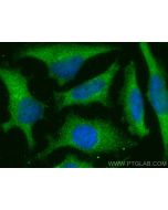SHOC2/Sur-8 Polyclonal antibody 17561-1-AP proteintech