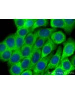 RIPK3 Polyclonal antibody, PBS Only 17563-1-PBS proteintech