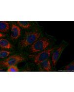 ATP5H Polyclonal antibody 17589-1-AP proteintech