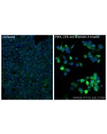 TNF-alpha Polyclonal antibody 17590-1-AP proteintech