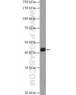 KLF17 Polyclonal antibody 17612-1-AP proteintech