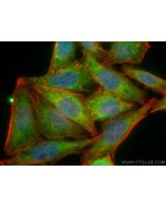 GSTT2B Polyclonal antibody 17622-1-AP proteintech