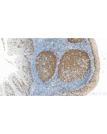 Ki-67 Polyclonal antibody Proteintech  27309-1-AP