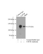 USP28 Polyclonal antibody 17707-1-AP proteintech