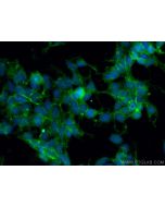MPP5 Polyclonal antibody 17710-1-AP proteintech