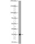 ULBP1 Polyclonal antibody 17715-1-AP proteintech