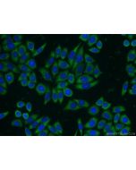 RANBP9 Polyclonal antibody 17755-1-AP proteintech