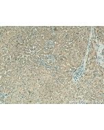 VPS16 Polyclonal antibody 17776-1-AP proteintech