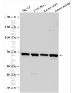 SLC6A18 Polyclonal antibody 17876-1-AP proteintech