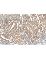 BHLHE40 Polyclonal antibody 17895-1-AP proteintech