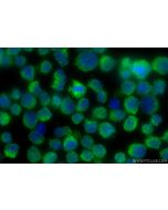 DEFA6 Polyclonal antibody 17923-1-AP proteintech