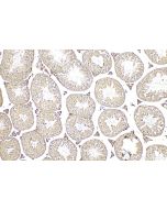 MAGEB3 Polyclonal antibody 18000-1-AP proteintech