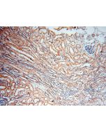 CARD6 Polyclonal antibody 18029-1-AP proteintech