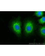 LONP2 Polyclonal antibody 18035-1-AP proteintech